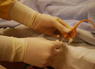 Czy cewnik może się Zatkać?